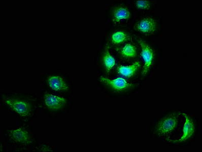 OTUD5 Antibody - Immunofluorescence staining of A549 cells with OTUD5 Antibody at 1:100, counter-stained with DAPI. The cells were fixed in 4% formaldehyde, permeabilized using 0.2% Triton X-100 and blocked in 10% normal Goat Serum. The cells were then incubated with the antibody overnight at 4°C. The secondary antibody was Alexa Fluor 488-congugated AffiniPure Goat Anti-Rabbit IgG(H+L).