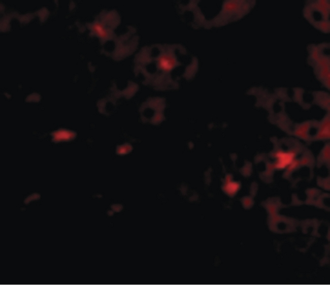 OTUD5 Antibody - Immunofluorescence of OTUD5 in Human Kidney cells with OTUD5 antibody at 20 ug/ml.