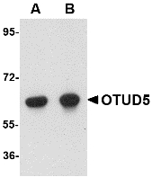 OTUD5 Antibody - Western blot of OTUD5 in human kidney lysate with OTUD5 antibody at (A) 1 and (B) 2 ug/ml.