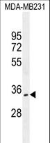 OTUD6A Antibody - OTUD6A Antibody western blot of MDA-MB231 cell line lysates (35 ug/lane). The OTUD6A antibody detected the OTUD6A protein (arrow).