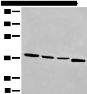 OTUD6A Antibody - Western blot analysis of Human breast cancer tissue TM4 231 and Jurkat cell lysates  using OTUD6A Polyclonal Antibody at dilution of 1:550