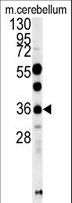 OTUD6B Antibody - OTUD6B Antibody western blot of mouse cerebellum tissue lysates (15 ug/lane). The OTUD6B antibody detected OTUD6B protein (arrow).