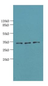 OTUD6B Antibody - Western blot. All lanes: OTUD6B antibody at 4 ug/ml. Lane 1: PC-3 whole cell lysate. Lane 2: 293T whole cell lysate. Lane 3: MDA-MB-231 whole cell lysate. Secondary Goat polyclonal to Rabbit IgG at 1:10000 dilution. Predicted band size: 34 kDa. Observed band size: 34 kDa.