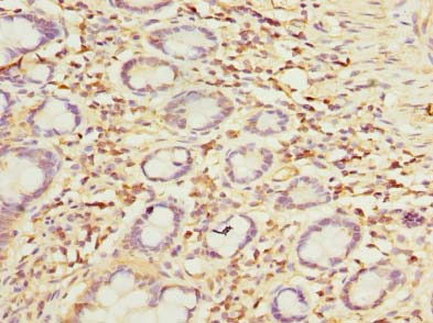 OTUD6B Antibody - Immunohistochemistry of paraffin-embedded human small intestine tissue using antibody at dilution of 1:100.