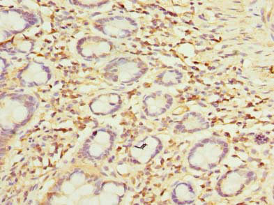 OTUD6B Antibody - Immunohistochemistry of paraffin-embedded human small intestine tissue using OTUD6B Antibody at dilution of 1:100