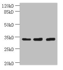 OTUD6B Antibody - Western blot All lanes: OTUD6B antibody at 4µg/ml Lane 1: PC-3 whole cell lysate Lane 2: 293T whole cell lysate Lane 3: MDA-MB-231 whole cell lysate Secondary Goat polyclonal to rabbit IgG at 1/10000 dilution Predicted band size: 34, 22 kDa Observed band size: 34 kDa