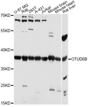 OTUD6B Antibody - Western blot analysis of extracts of various cell lines, using OTUD6B antibody at 1:3000 dilution. The secondary antibody used was an HRP Goat Anti-Rabbit IgG (H+L) at 1:10000 dilution. Lysates were loaded 25ug per lane and 3% nonfat dry milk in TBST was used for blocking. An ECL Kit was used for detection and the exposure time was 30s.