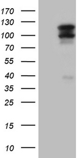 OTUD7B / Cezanne Antibody - HEK293T cells were transfected with the pCMV6-ENTRY control. (Left lane) or pCMV6-ENTRY OTUD7B. (Right lane) cDNA for 48 hrs and lysed