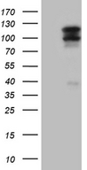 OTUD7B / Cezanne Antibody - HEK293T cells were transfected with the pCMV6-ENTRY control. (Left lane) or pCMV6-ENTRY OTUD7B. (Right lane) cDNA for 48 hrs and lysed