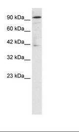 OTUD7B / Cezanne Antibody - Daudi Cell Lysate.  This image was taken for the unconjugated form of this product. Other forms have not been tested.