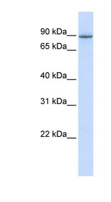 OTUD7B / Cezanne Antibody - OTUD7B antibody Western blot of 293T cell lysate. This image was taken for the unconjugated form of this product. Other forms have not been tested.