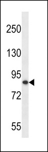 OTUD7B / Cezanne Antibody - OTU7B Antibody western blot of MDA-MB453 cell line lysates (35 ug/lane). The OTU7B antibody detected the OTU7B protein (arrow).