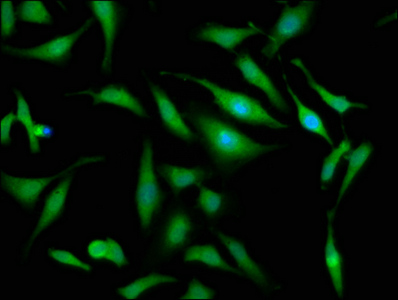 OTUD7B / Cezanne Antibody - Immunofluorescence staining of Hela cells at a dilution of 1:133, counter-stained with DAPI. The cells were fixed in 4% formaldehyde, permeabilized using 0.2% Triton X-100 and blocked in 10% normal Goat Serum. The cells were then incubated with the antibody overnight at 4 °C.The secondary antibody was Alexa Fluor 488-congugated AffiniPure Goat Anti-Rabbit IgG (H+L) .