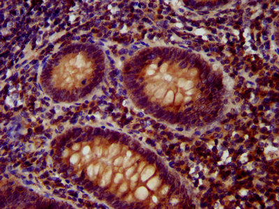 OTUD7B / Cezanne Antibody - Immunohistochemistry image at a dilution of 1:400 and staining in paraffin-embedded human appendix tissue performed on a Leica BondTM system. After dewaxing and hydration, antigen retrieval was mediated by high pressure in a citrate buffer (pH 6.0) . Section was blocked with 10% normal goat serum 30min at RT. Then primary antibody (1% BSA) was incubated at 4 °C overnight. The primary is detected by a biotinylated secondary antibody and visualized using an HRP conjugated SP system.