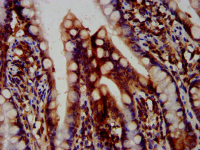OTUD7B / Cezanne Antibody - Immunohistochemistry image at a dilution of 1:400 and staining in paraffin-embedded human small intestine tissue performed on a Leica BondTM system. After dewaxing and hydration, antigen retrieval was mediated by high pressure in a citrate buffer (pH 6.0) . Section was blocked with 10% normal goat serum 30min at RT. Then primary antibody (1% BSA) was incubated at 4 °C overnight. The primary is detected by a biotinylated secondary antibody and visualized using an HRP conjugated SP system.
