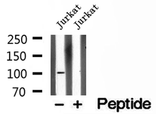 OTUD7B / Cezanne Antibody - Western blot analysis of extracts of Jurkat cells using OTUD7B antibody.