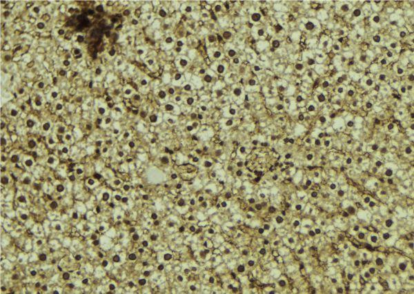 OTUD7B / Cezanne Antibody - 1:100 staining mouse liver tissue by IHC-P. The sample was formaldehyde fixed and a heat mediated antigen retrieval step in citrate buffer was performed. The sample was then blocked and incubated with the antibody for 1.5 hours at 22°C. An HRP conjugated goat anti-rabbit antibody was used as the secondary.