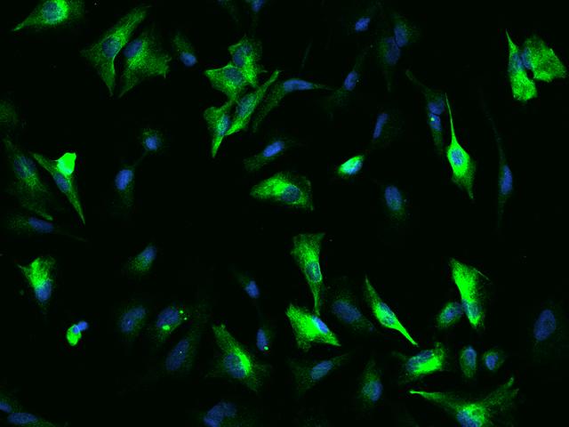 OTUD7B / Cezanne Antibody - Immunofluorescence staining of OTUD7B in U251MG cells. Cells were fixed with 4% PFA, permeabilzed with 0.1% Triton X-100 in PBS, blocked with 10% serum, and incubated with rabbit anti-Human OTUD7B polyclonal antibody (dilution ratio 1:200) at 4°C overnight. Then cells were stained with the Alexa Fluor 488-conjugated Goat Anti-rabbit IgG secondary antibody (green) and counterstained with DAPI (blue). Positive staining was localized to Cytoplasm.