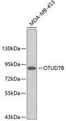 OTUD7B / Cezanne Antibody - Western blot analysis of extracts of MDA-MB-453 cells using OTUD7B Polyclonal Antibody.
