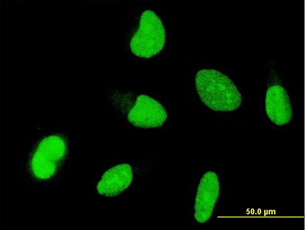 OTX1 Antibody - Immunofluorescence of monoclonal antibody to OTX1 on HeLa cell . [antibody concentration 10 ug/ml]