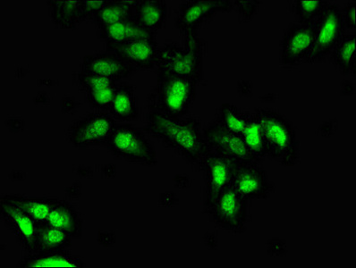OTX1 Antibody - Immunofluorescent analysis of Hela cells diluted at 1:100 and Alexa Fluor 488-congugated AffiniPure Goat Anti-Rabbit IgG(H+L)