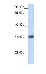 OTX2 Antibody - Fetal muscle lysate. Antibody concentration: 1.0 ug/ml. Gel concentration: 12%.  This image was taken for the unconjugated form of this product. Other forms have not been tested.