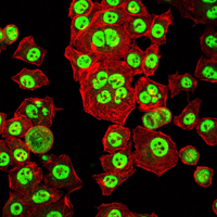 OTX2 Antibody - Immunofluorescence of HepG2 cells using OTX2 mouse monoclonal antibody (green). Red: Actin filaments have been labeled with Alexa Fluor-555 phalloidin.