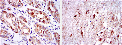 OTX2 Antibody - IHC of paraffin-embedded stomach tissues (left) and brain tissues (right) using OTX2 mouse monoclonal antibody with DAB staining.