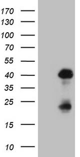 OTX2 Antibody - HEK293T cells were transfected with the pCMV6-ENTRY control. (Left lane) or pCMV6-ENTRY OTX2. (Right lane) cDNA for 48 hrs and lysed. Equivalent amounts of cell lysates. (5 ug per lane) were separated by SDS-PAGE and immunoblotted with anti-OTX2. (1:2000)