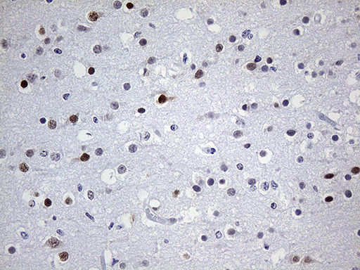 OTX2 Antibody - Immunohistochemical staining of paraffin-embedded Human embryonic brain cortex tissue within the normal limits using anti-OTX2 mouse monoclonal antibody. (Heat-induced epitope retrieval by 1mM EDTA in 10mM Tris buffer. (pH8.5) at 120 oC for 3 min. (1:250)