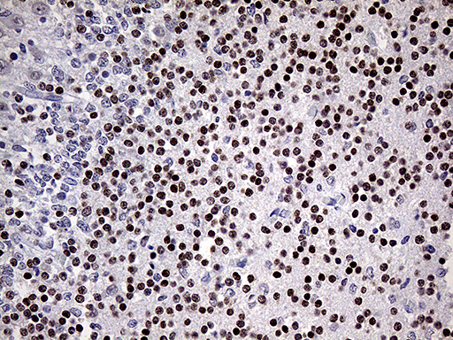 OTX2 Antibody - Immunohistochemical staining of paraffin-embedded Human embryonic cerebellum within the normal limits using anti-OTX2 mouse monoclonal antibody. (Heat-induced epitope retrieval by 1mM EDTA in 10mM Tris buffer. (pH8.5) at 120 oC for 3 min. (1:250)