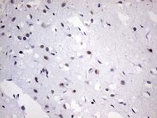 OTX2 Antibody - Immunohistochemical staining of paraffin-embedded Human adult brain tissue within the normal limits using anti-OTX2 mouse monoclonal antibody. (Heat-induced epitope retrieval by 1mM EDTA in 10mM Tris buffer. (pH8.5) at 120 oC for 3 min. (1:250)