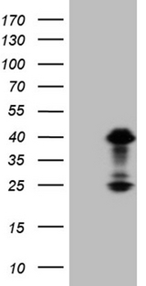 OTX2 Antibody - HEK293T cells were transfected with the pCMV6-ENTRY control. (Left lane) or pCMV6-ENTRY OTX2. (Right lane) cDNA for 48 hrs and lysed. Equivalent amounts of cell lysates. (5 ug per lane) were separated by SDS-PAGE and immunoblotted with anti-OTX2. (1:2000)