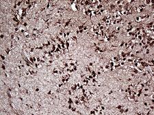 OTX2 Antibody - Immunohistochemical staining of paraffin-embedded Human embryonic brain cortex tissue within the normal limits using anti-OTX2 mouse monoclonal antibody. (Heat-induced epitope retrieval by 1mM EDTA in 10mM Tris buffer. (pH8.5) at 120 oC for 3 min. (1:500)