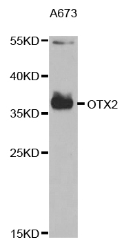 OTX2 Antibody - Western blot analysis of extracts of A673 cells.