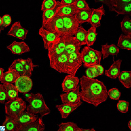OTX2 Antibody - Immunofluorescence (IF) analysis of HepG2 cells using OTX2 Monoclonal Antibody (green). Red: Actin filaments have been labeled with Alexa Fluor-555 phalloidin.