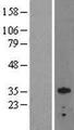 OTX2 Protein - Western validation with an anti-DDK antibody * L: Control HEK293 lysate R: Over-expression lysate