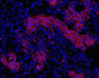 Oval Cell Marker OC2 Antibody - Oval Cell Marker Antibody (OC2-2A6) - IHC of DDC treated mouse liver.  This image was taken for the unconjugated form of this product. Other forms have not been tested.