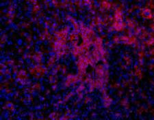 Oval Cell Marker OC2 Antibody - Oval Cell Marker Antibody (OC2-4E8) - IHC of DDC treated mouse liver.