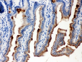 Anti-Ovalbumin Antibody | Rabbit anti-Human Polyclonal ICC,IHC,WB | LSBio