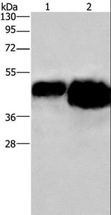 Ovalbumin Antibody - Western blot analysis of 0.4ug and 0.8ug OVAL protein, using OVAL Polyclonal Antibody at dilution of 1:500.