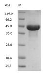 Ovalbumin Protein - (Tris-Glycine gel) Discontinuous SDS-PAGE (reduced) with 5% enrichment gel and 15% separation gel.