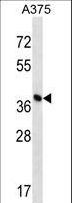 OVCA1 / DPH1 Antibody - DPH1 Antibody western blot of A375 cell line lysates (35 ug/lane). The DPH1 antibody detected the DPH1 protein (arrow).