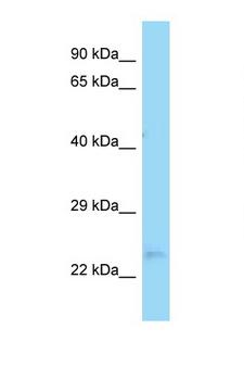 OVCA2 Antibody - OVCA2 antibody Western blot of Rat Lung lysate. Antibody concentration 1 ug/ml.  This image was taken for the unconjugated form of this product. Other forms have not been tested.