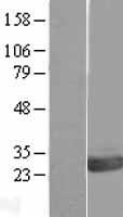 OVCA2 Protein - Western validation with an anti-DDK antibody * L: Control HEK293 lysate R: Over-expression lysate