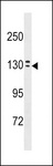 OVCH1 Antibody - OVCH1 Antibody western blot of A549 cell line lysates (35 ug/lane). The OVCH1 antibody detected the OVCH1 protein (arrow).