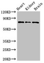OVGP1 / Oviductin Antibody - Western Blot Positive WB detected in:Mouse heart tissue,Mouse kidney tissue,Mouse brain tissue All Lanes:OVGP1 antibody at 3µg/ml Secondary Goat polyclonal to rabbit IgG at 1/50000 dilution Predicted band size: 76 KDa Observed band size: 76 KDa