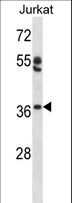 OVOL1 Antibody - OVOL1 Antibody western blot of Jurkat cell line lysates (35 ug/lane). The OVOL1 antibody detected the OVOL1 protein (arrow).