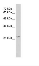 OVOL1 Antibody - Jurkat Cell Lysate.  This image was taken for the unconjugated form of this product. Other forms have not been tested.