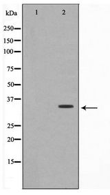 OVOL1 Antibody - Western blot of A549 cell lysate using OVOL1 Antibody
